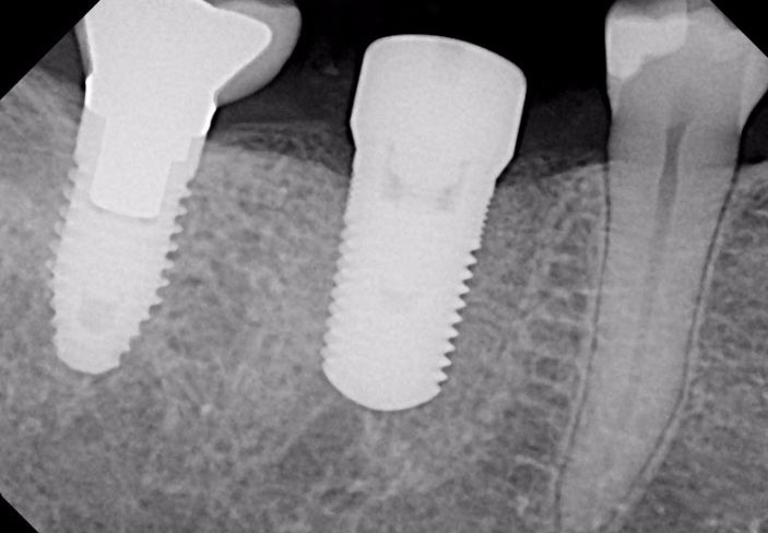HighDental Berlin Mitte