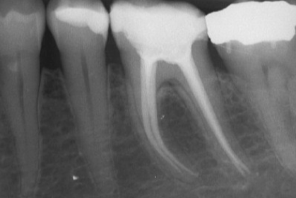 HighDental Berlin Mitte